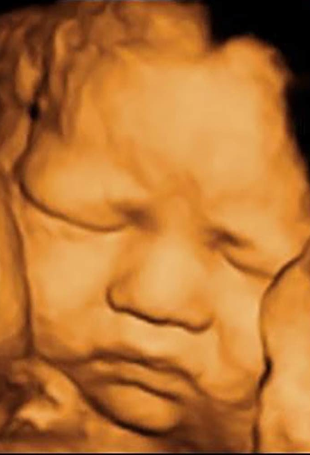 3d ultrasounds at 30 weeks